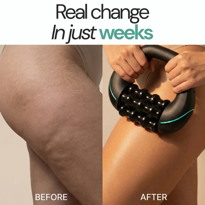 Antes y después Rollshaper